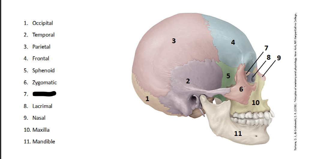 <p>What landmark within the <strong>Skull? (LATERAL)</strong></p>