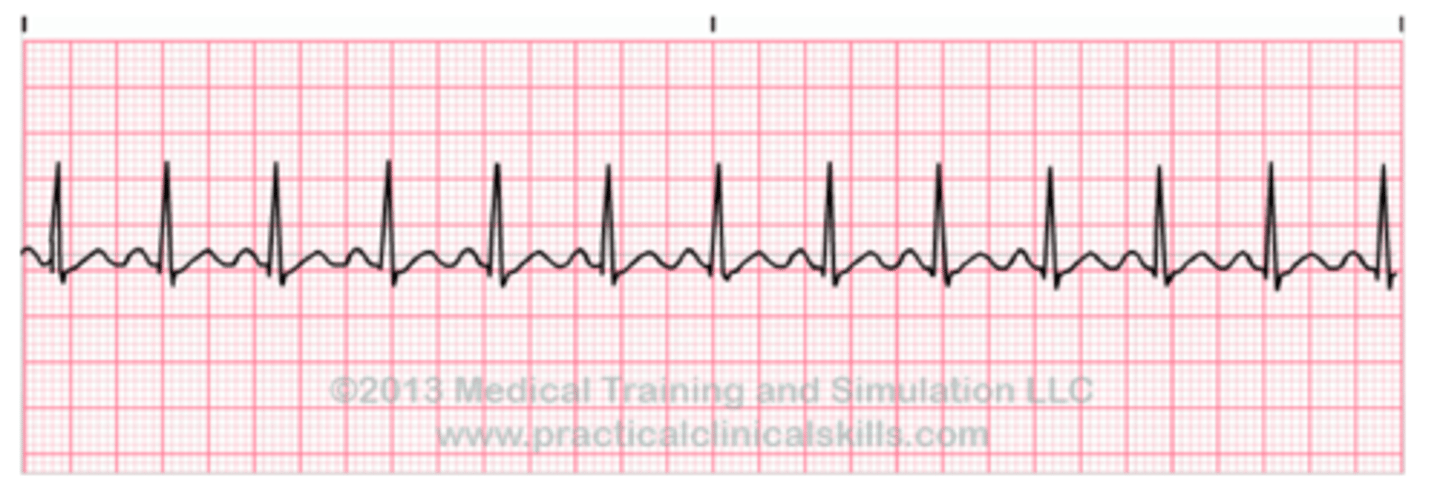 <p>number of heart beats per minute</p>