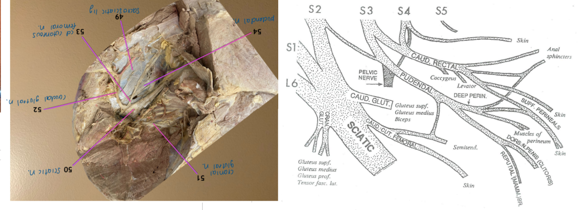 <ol start="49"><li><p>sacrosciatic ligament: white CT sheet deep to nerves in the lumbosacral plexus</p></li></ol><ol start="54"><li><p>pudendal n.</p></li></ol><p></p>