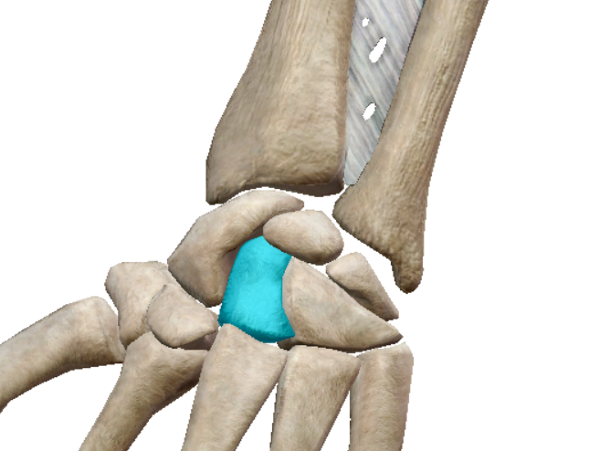 term image