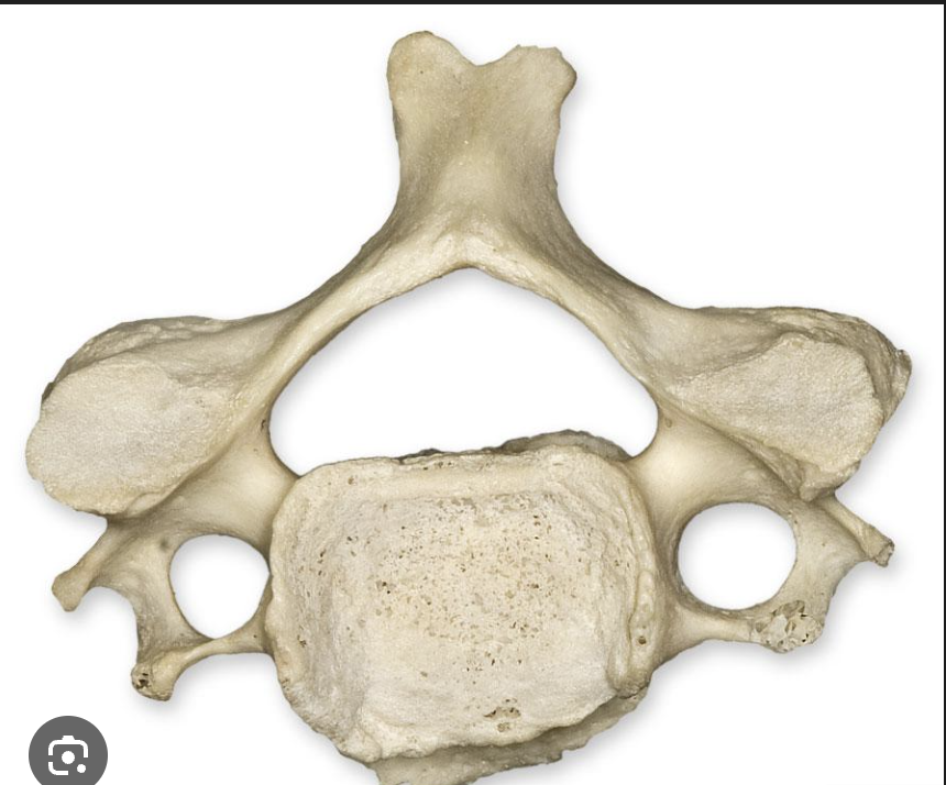 <p>what vertebrae is this? </p>