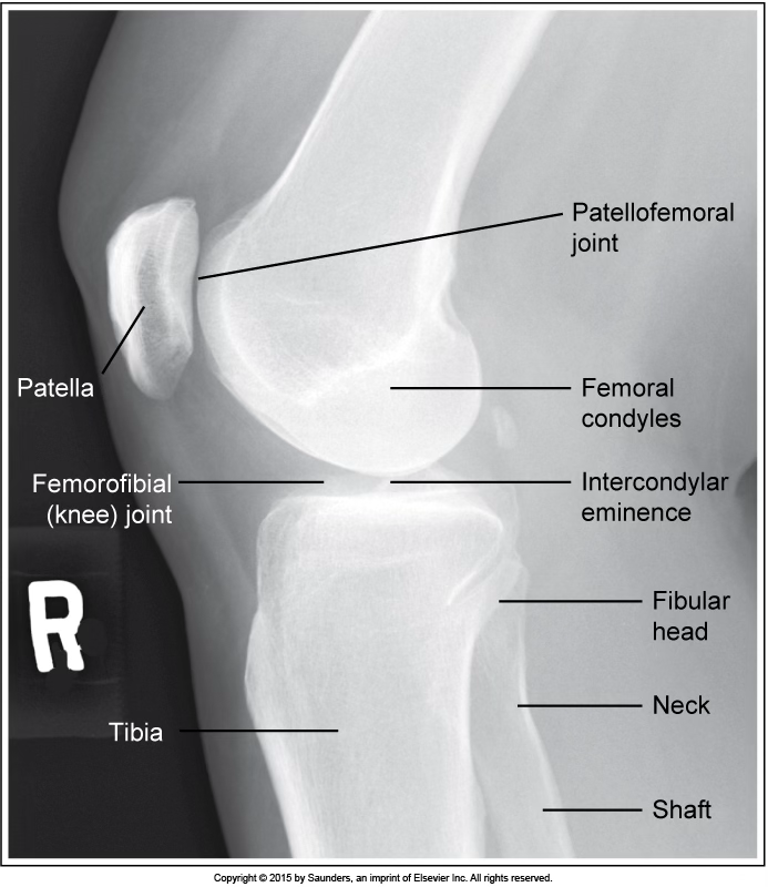 <p>lateral knee</p>