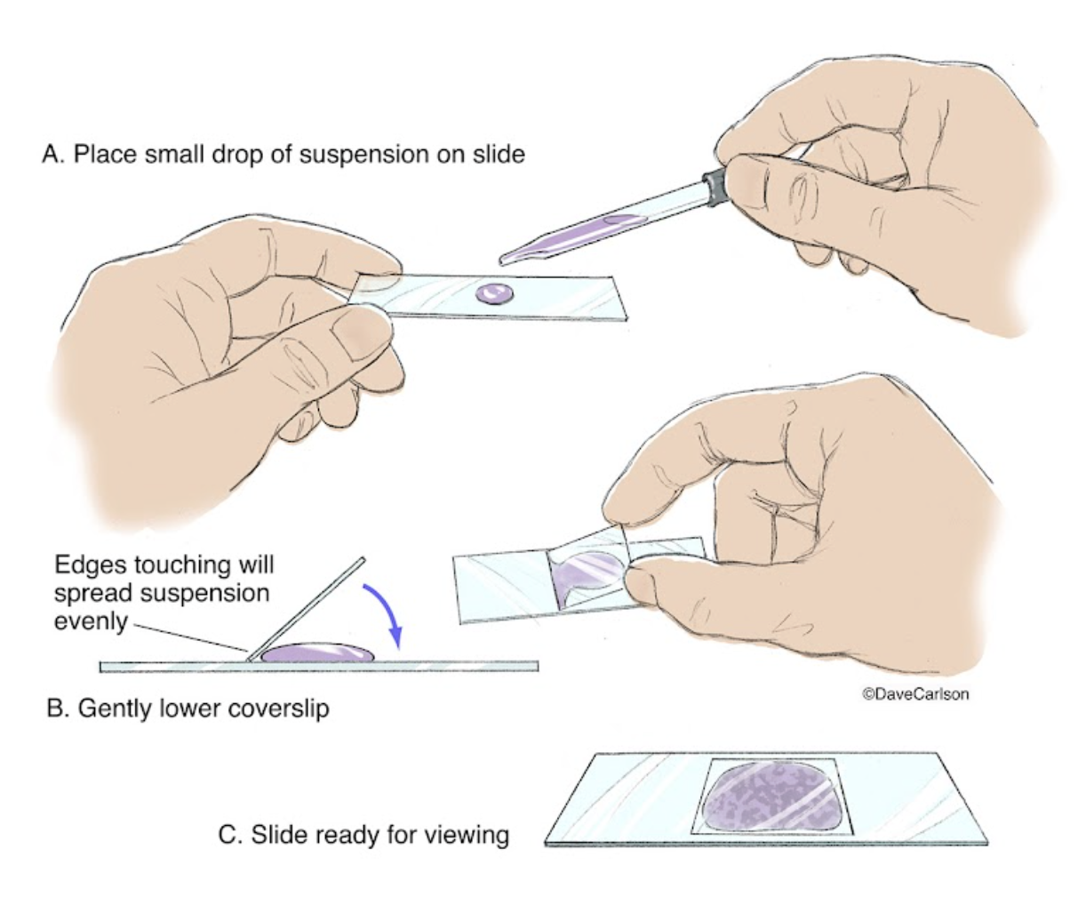 <p><span style="line-height: 1.5;">26. Observe the diagram below. When preparing a wet mount slide to observe onion root tip cells under a microscope, which step(s) are essential for obtaining a clear view of cell structures?</span></p><p><span style="line-height: 1.5;">A. Place the onion skin directly on the slide without adding any liquid.</span></p><p><span style="line-height: 1.5;">B. Add a drop of water and gently lower the coverslip to avoid air bubbles.</span></p><p><span style="line-height: 1.5;">C. Use dry mounting to prevent distortion of the cells.</span></p><p><span style="line-height: 1.5;">D. Apply multiple layers of coverslips for better magnification.</span></p>