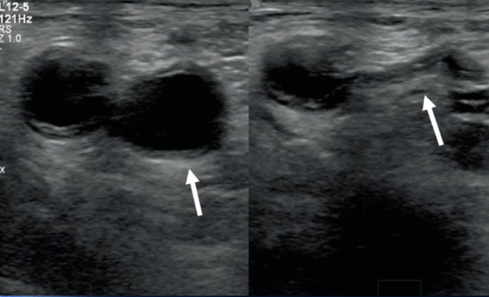 <p>what is the arrow pointing to</p>