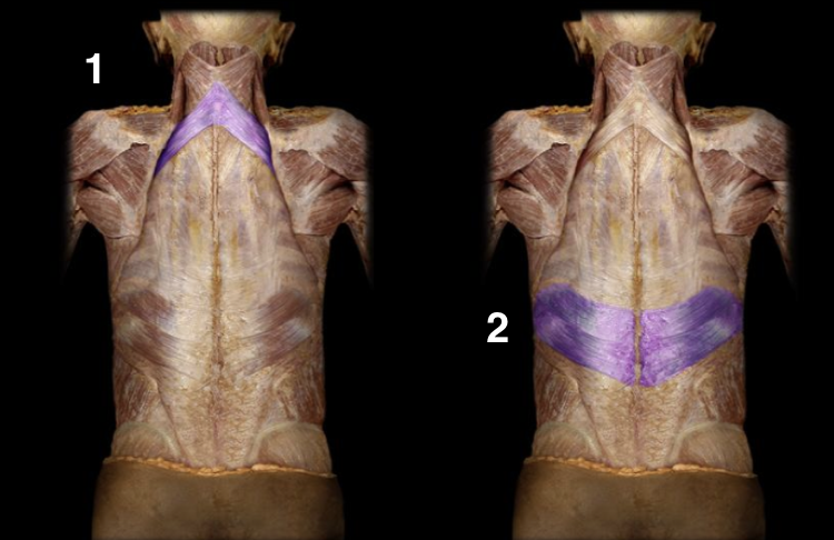 <p>In the intermediate back muscles what is the structure called labeled as 1?</p>