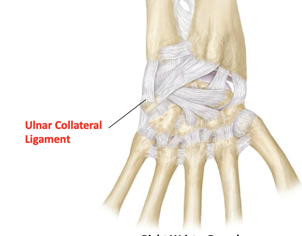 <p>Ulnar collateral ligament (intercarpal)</p>