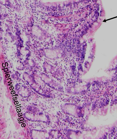 <p>soort weefsel</p>