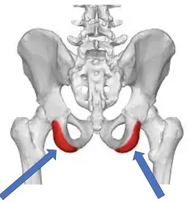 <p>Ischial Tuberosity (Ischium)</p>