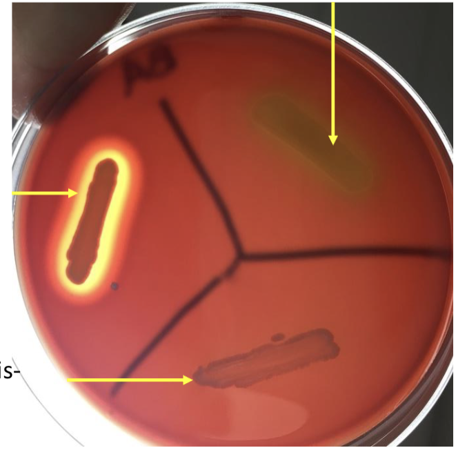<p>what <strong>type</strong> of agar? s or d?</p>