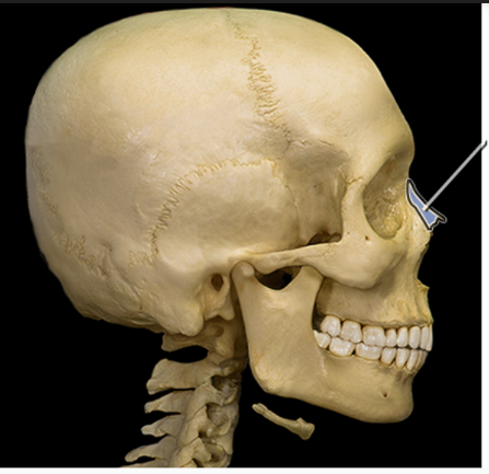 <p>What structure is indicated</p>