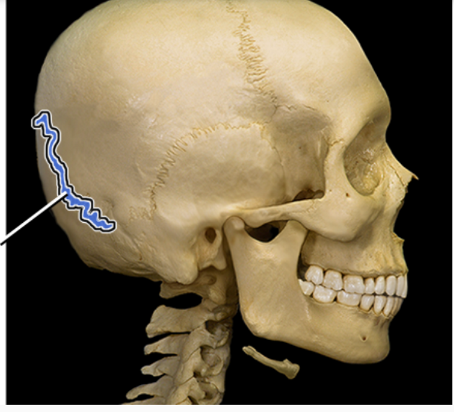 <p>What structure is indicated</p>