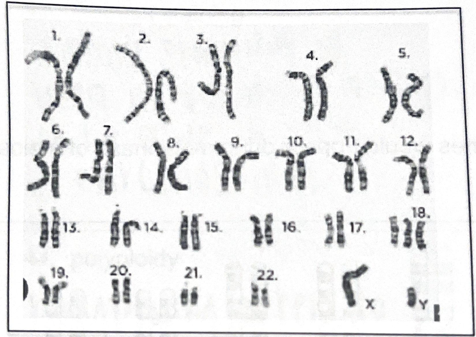 <p>examine the karyotype</p>