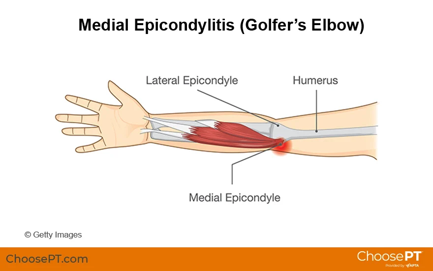 <p>bump on medial side of elbow</p>