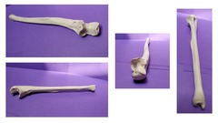 <p>name of bone (multiple examples are indicated)</p>