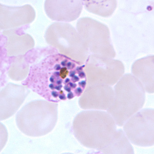 <p>4-16 merozoites</p><p>Oval shape with fibrillation (jagged edges) common</p><p>Lighter, less coarse pigment</p>