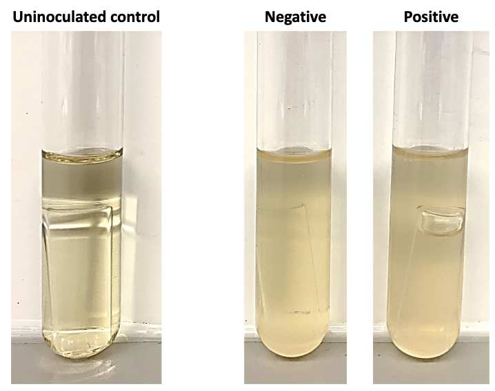 <ul><li><p>Turbidity in the tube indicates organism growth, but turbidity by itself does not prove nitrate reduction</p></li><li><p>A positive result is the presence of a bubble in the Durham tube (indicates formation of nitrogenous gas - denitrification)</p></li><li><p>A negative result is no bubble in Durham vial; no evidence of gas production; organism does not fully reduce nitrate (unknown result)</p></li></ul><p></p>