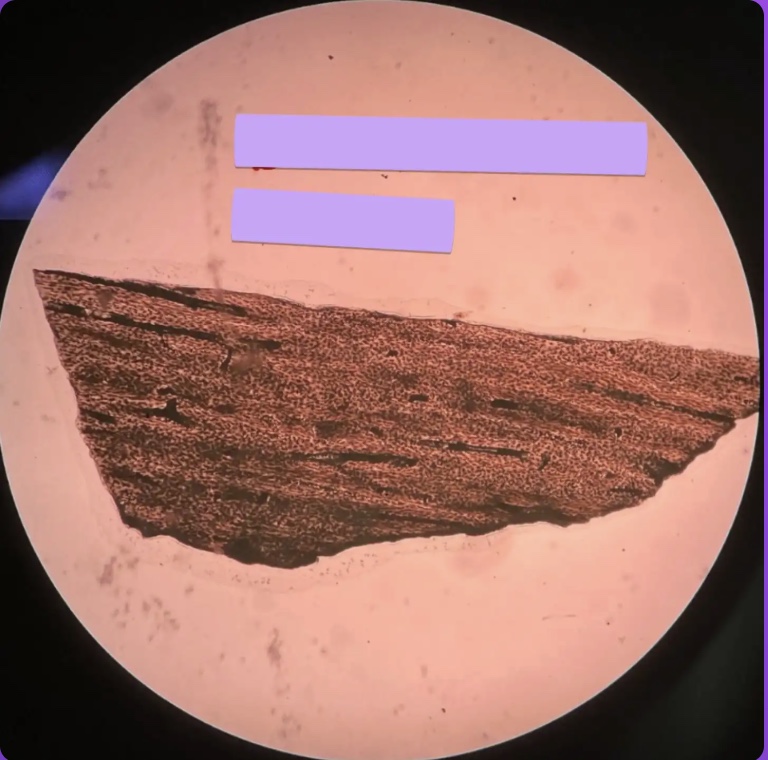 <p>What kind of tissue is this?</p>