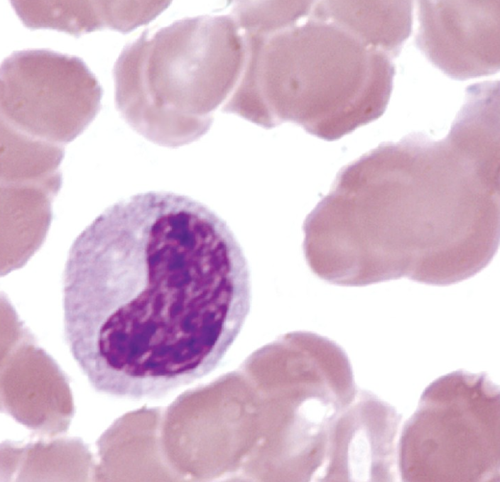 <p>What WBC precursor is this?</p>