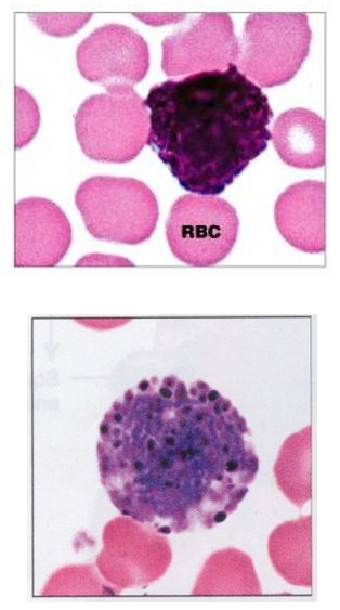 <ul><li><p><1% of WBC (rare)</p></li><li><p>large dark purple, irregularly sized granules; nucleus is irregularly shaped bi-lobed, however obscured from view by granules when stained</p></li></ul><p></p><p>Function:</p><ul><li><p>involved in inflammatory and allergic reactions - release histamine</p></li><li><p>counts increase w/ allergic rxns, leukemia, diabetes, and autoimmune disorders</p></li></ul><p></p>