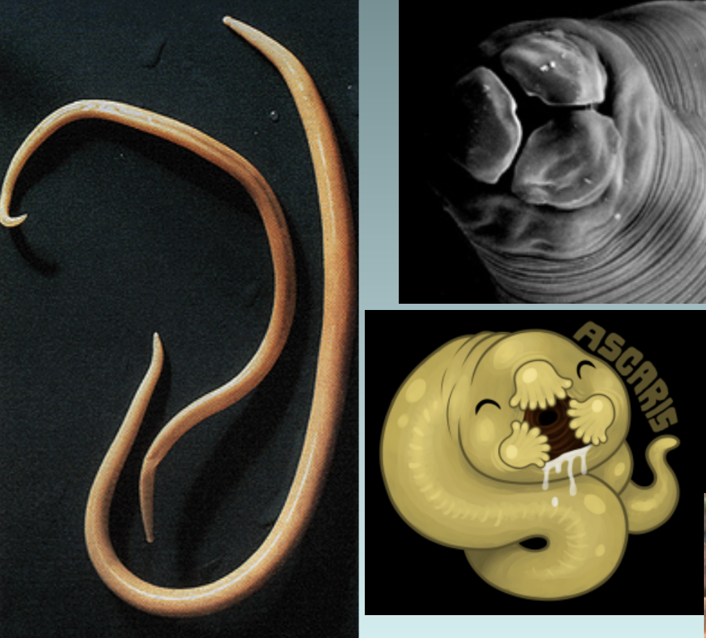 <p>ascaris lumbricoides</p>