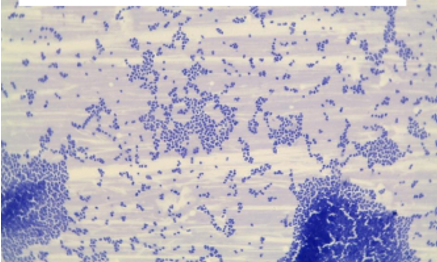 <p>Bacteria species:</p><p>Acid-fast + / -: </p><p></p>
