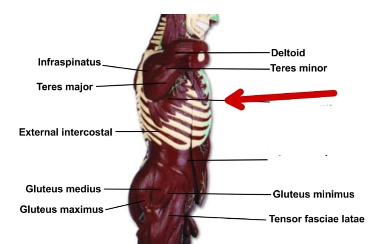term image