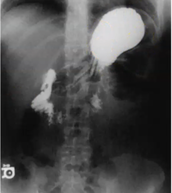 <p>What projection is this? (barium in fundus)</p>