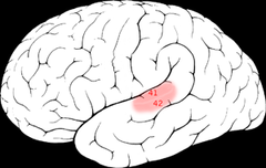 <p>makes you aware you heard something (primary auditory cortex)</p>