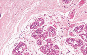 <p>What pathology?</p>