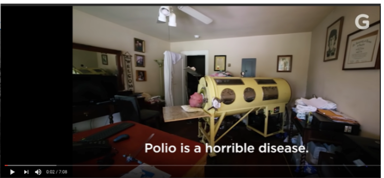 <p>Muscle weakness + Nerve inactivation = Paralysis</p><ul><li><p>if in the thoracic region = cannot breathe</p></li></ul><p></p><p>eg. Paul Alexander age 72 Texas</p>