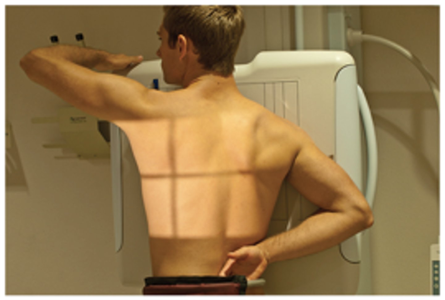 <p>angle that places right anterior portion of the body closest to the image receptor; usually 45 degree angle</p>