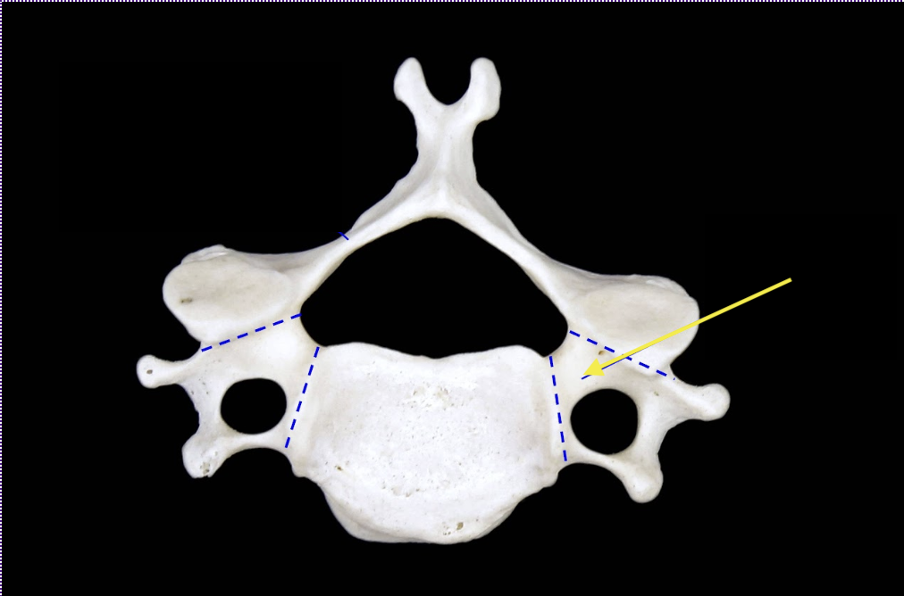 <p>Pedicle</p>