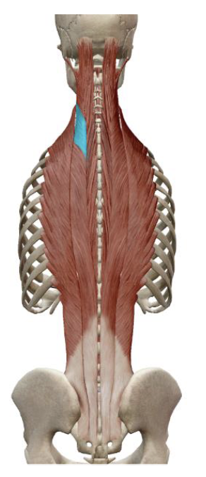 <p>which muscle, origin, insertion, innervation, and action is this</p>