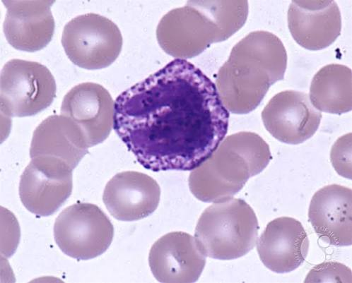 <p>What Leukocyte is this?</p>