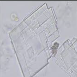 <p>Flat plates with corner notches</p><p>Abnormal crystals, seen with lipiduria/proteinuria </p>