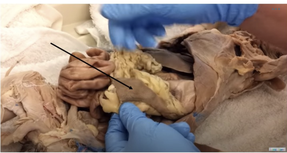 <p>Identify the organ indicated by the pointer.</p>