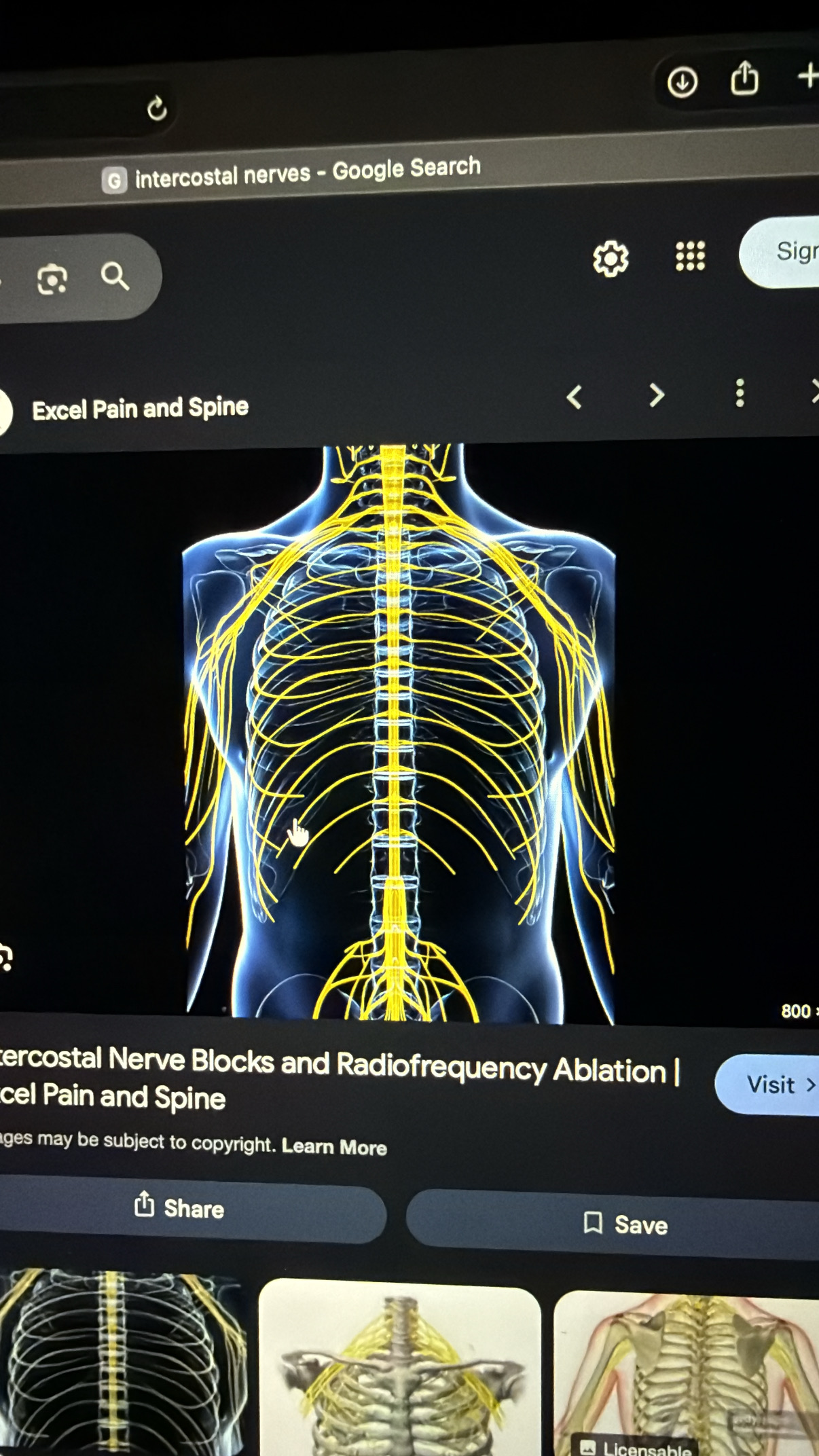 <p>rib nerves</p>