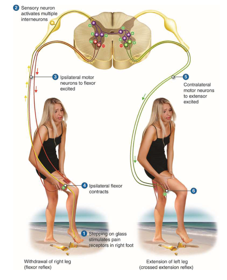 <p>occurs when a person has a painful stimulus when the foot is on the ground</p><ul><li><p>response: flexion in ipsilateral LE with extension of contralateral LE</p></li></ul><p></p>