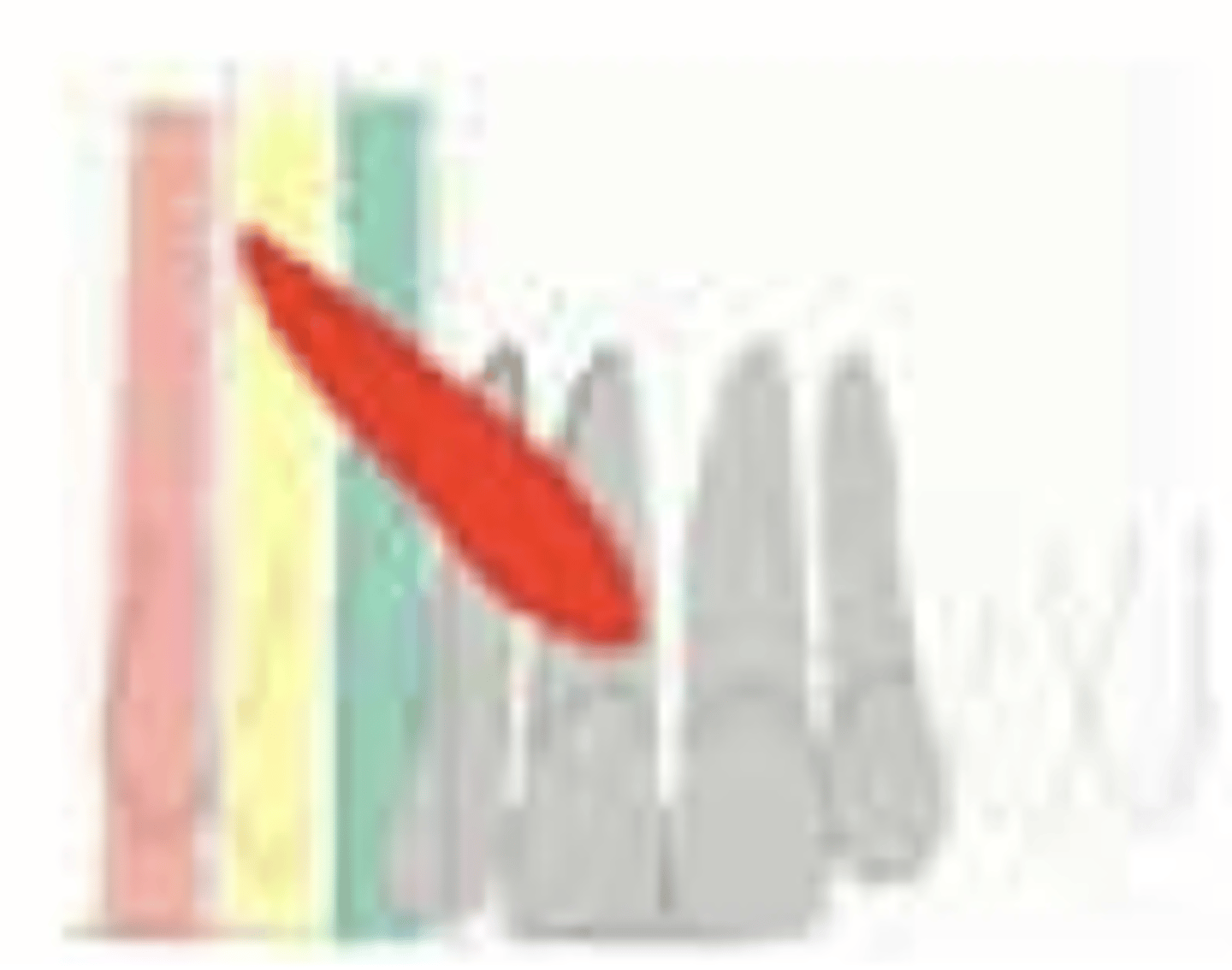 <p>What is the prognosis?</p><p>- Position of apex: Above 1st premolar</p>