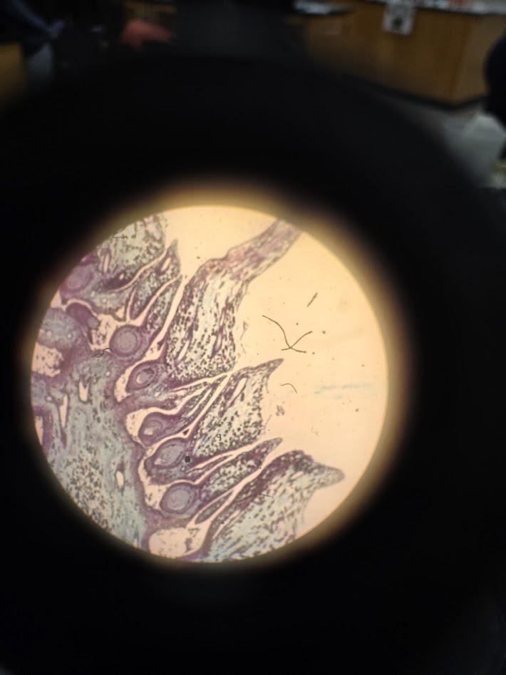<ol><li><p>what is the phylum?</p></li><li><p>what is the structure?</p></li><li><p>what is the ploidy?</p></li></ol><p></p>