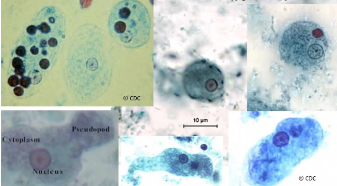 <ul><li><p><span style="background-color: transparent;">Motility is progressive and rapid. </span></p></li><li><p><span style="background-color: transparent;">Finger-like pseudopods</span></p></li><li><p><span style="background-color: transparent;">12-60 um</span></p></li><li><p><span style="background-color: transparent;">1 nucleus</span></p></li><li><p><span style="background-color: transparent;">PC = fine</span></p></li><li><p><span style="background-color: transparent;">K = central</span></p></li><li><p><span style="background-color: transparent;">Cytoplasm appears green. Vacuoles can be present.</span></p></li><li><p><span style="background-color: transparent;">Can have inclusions (<strong>RBCs</strong>)→ good differentiator btw histolytica and dispar.</span></p></li></ul><p></p>