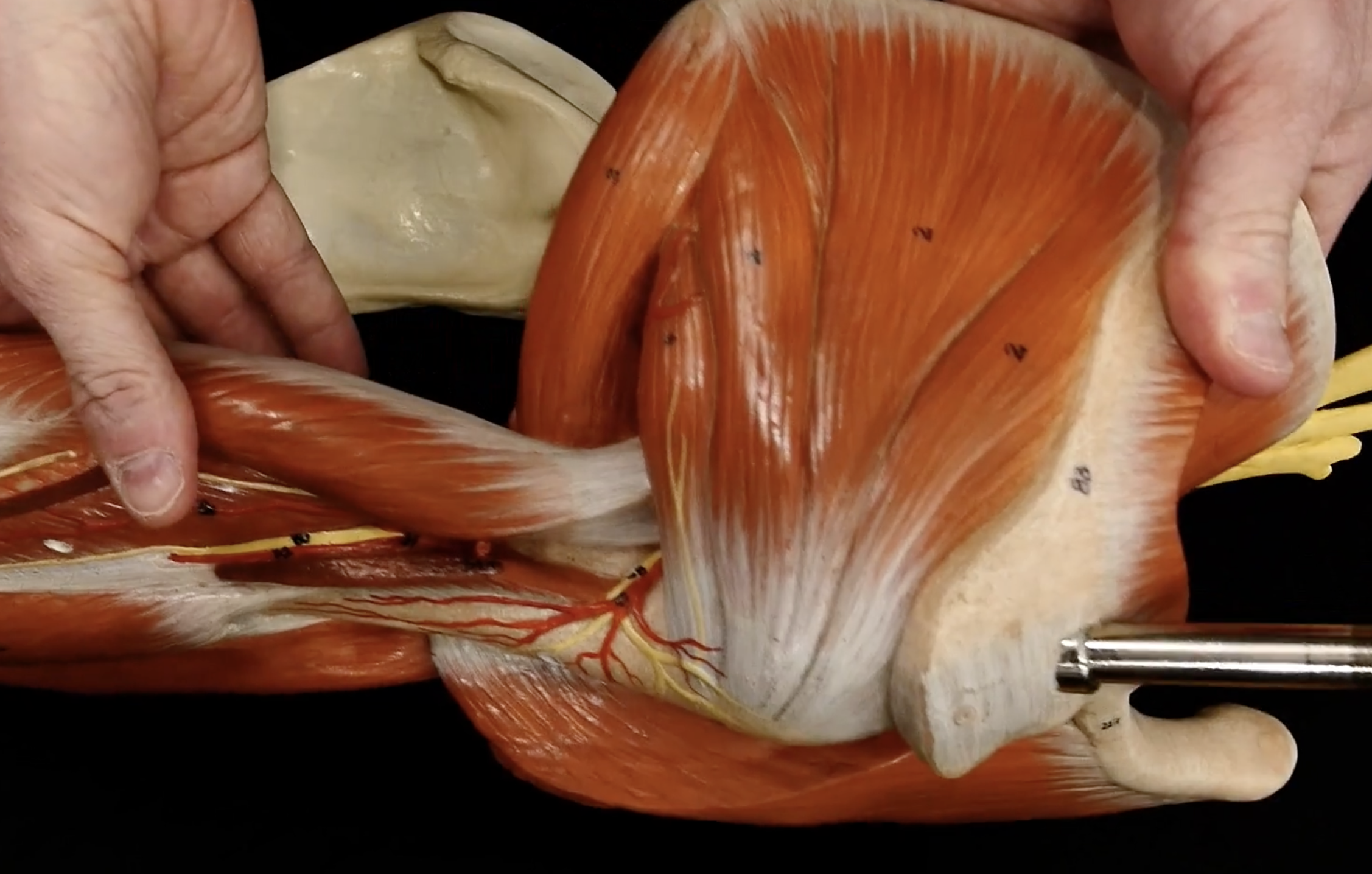 <p>the top boney part is the spine of the scapula, based off that.. where is the infra spinatus?</p>