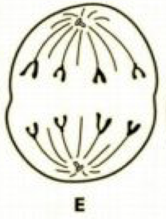 <p>What stage of mitosis is this?</p>