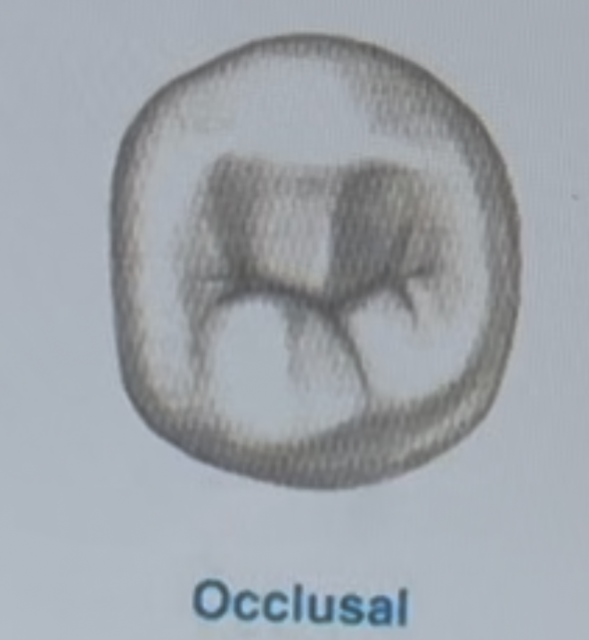 <p>Which premolar is shown in the diagram: maxillary right first premolar, maxillary right second premolar, mandibular right first premolar, mandibular right second premolar</p>