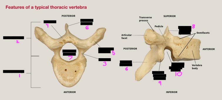 <p>label this diagram of the basic vertebral structures</p>