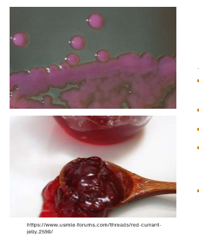 <p>LF, moist/mucoid</p><img src="https://assets.knowt.com/user-attachments/72d4d34a-61ea-4b82-9c9a-b1741e558f91.png" data-width="25%" data-align="center" alt="knowt flashcard image"><p></p>