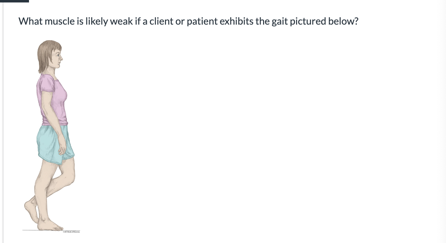 <p><span>What muscle is likely weak if a client or patient exhibits the gait pictured below?</span></p>
