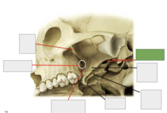 <p>Inferolateral view: This is the</p>