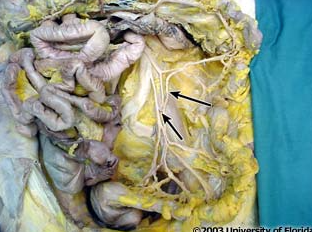 <p>what artery is pictured (context, loops of the small intestine have been removed)?</p>