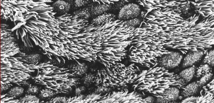 <p>What are these frilly things that can be found in the trachea?</p>